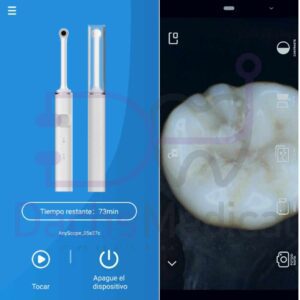 Camara intraoral smart Ios android  inalambrica