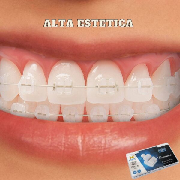 caso-estetico-ceramico-morelli-ortodoncia-odontologia-blackfriday-deposito-dental-ecuador