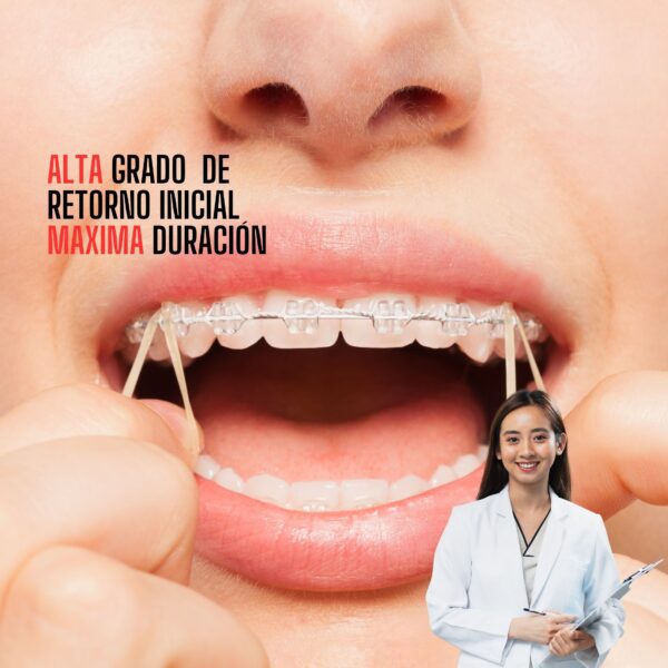 ligas-para-ortodoncia-odontologia-intermaxilares-blackfriday-deposito-dental-ecuador